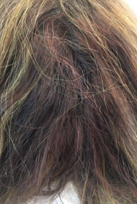 Antes